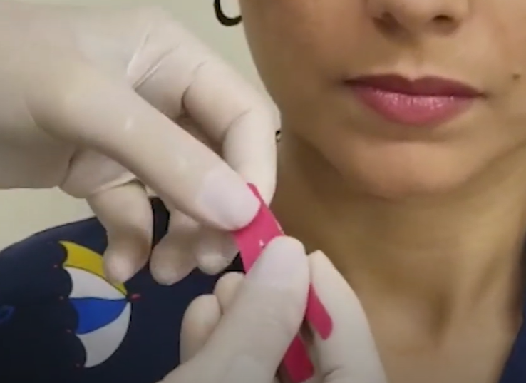 Primeiro passo para colar: cortar os dedinhos da bandagem do orbicular dos olhos – Motility Oral 