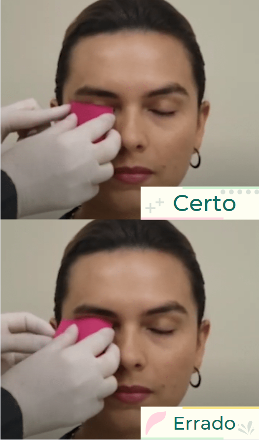 Primeiro passo para cortar: certo e errado da bandagem no orbicular dos olhos – Motility Oral 