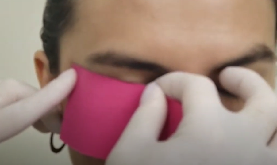 Primeiro passo para cortar: medir o tamanho da bandagem no orbicular dos olhos – Motility Oral 