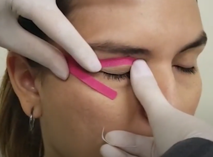 Quarto passo para colar: contornar o olho com a bandagem em cima do orbicular dos olhos – Motility Oral 