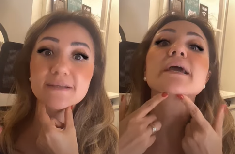 Bandagem funcional AVC: Representação da bandagem milo-hióidea na live que pega toda a musculatura supra-hióidea - Motility Oral.