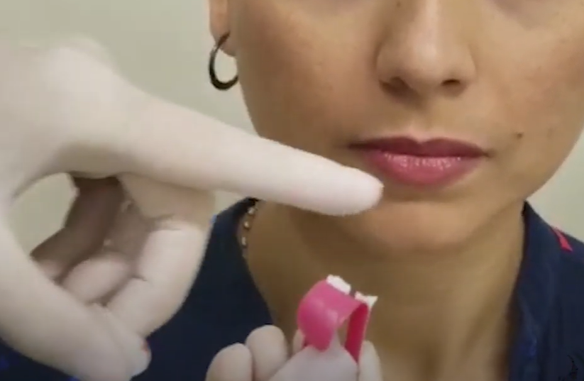 Segundo passo para colar: tirar a proteção da cola da bandagem da parte que fica nas têmporas – Motility Oral 