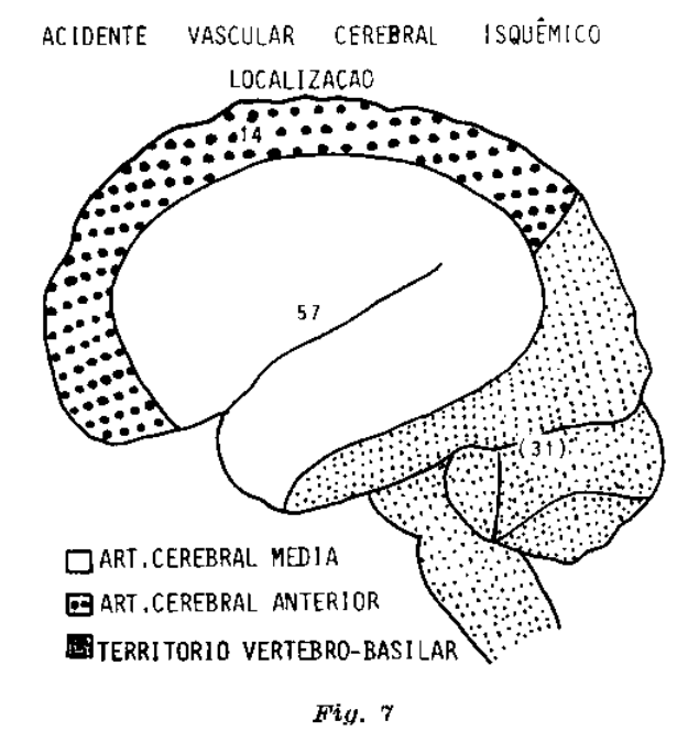 Prevalência da localização da artéria cerebral média em detrimento de outras para um AVCi