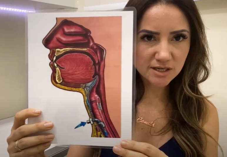 Imagem de praxe para os preditivos para a decanulação – Camila Pereira, Motility Oral